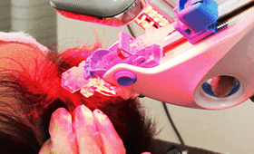 豊富な発毛プラン